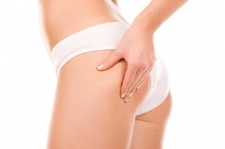 Le Massage « Anti-Cellulite »